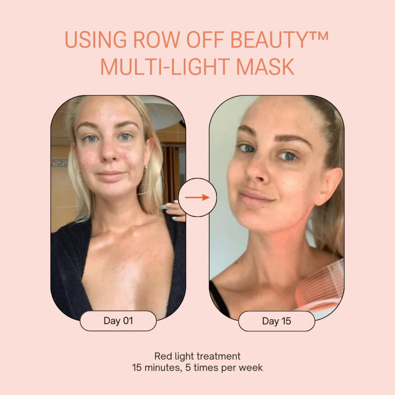 Row of Beauty™ Multi-Light Face Mask