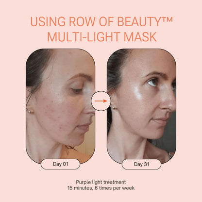 Row of Beauty™ Multi-Light Face Mask